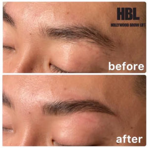 ハリウッドブロウリフト